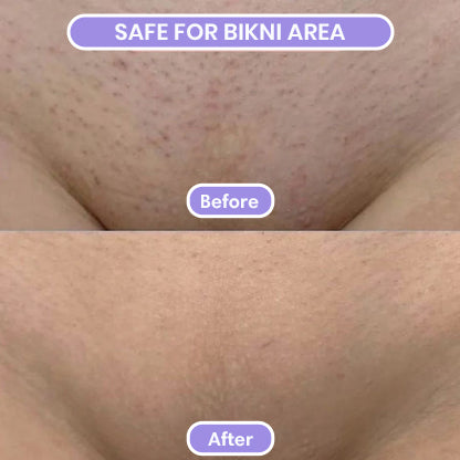 2 in 1 Women Body Shaver