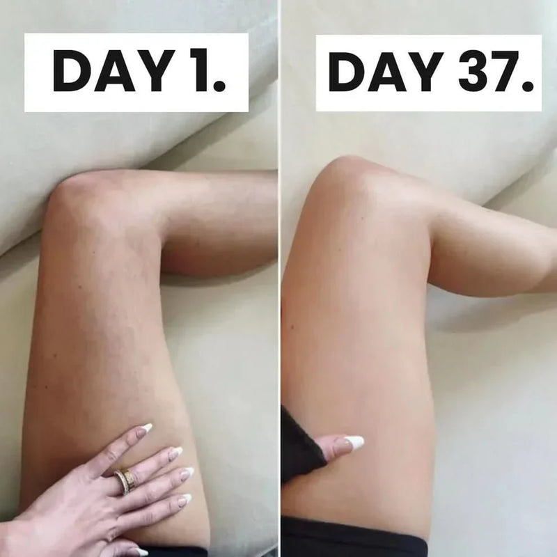 Alamaraat™ Cellulite Relief Kit