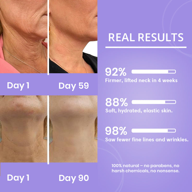 Tighten and Lift Neck Cream