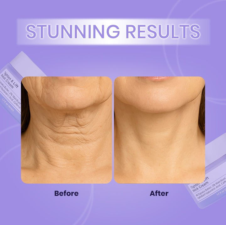 Tighten and Lift Neck Cream