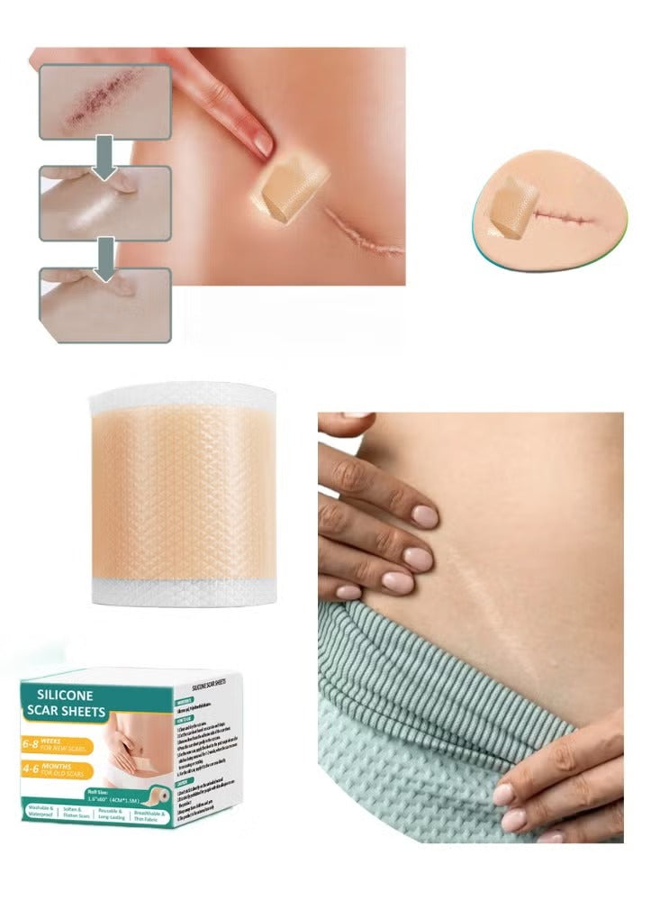 Silicone Scar Sheets