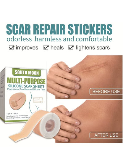 Silicone Scar Sheets